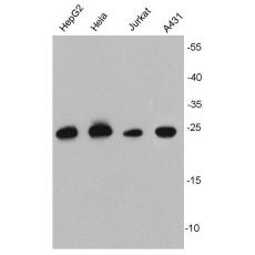 Anti-HSP27 antibody [10-8]