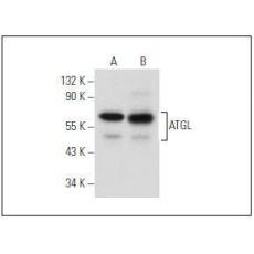 Anti-ATGL antibody [4G5]