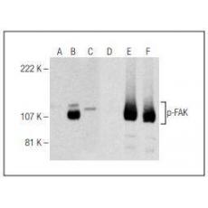 Anti-Phospho-FAK (Ser 722) antibody [4G1]