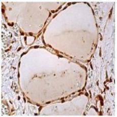 Anti-Smad2/3 antibody [4D3]