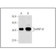 Anti-hnRNP A1 antibody [1G2]