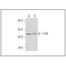 Anti-LOX-1 antibody [2G5]