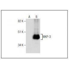 Anti-MKP-3 antibody [3G1]