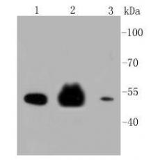 Anti-Cytokeratin 8 antibody [A1-B11]