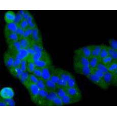 Anti-PI3-kinase p85 subunit alpha antibody [A3-D0]