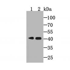 Anti-Haptoglobin antibody [5-D3]