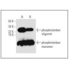 Anti-Phospholamban antibody [1G3]