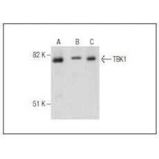 Anti-NAK / TBK1 antibody [2G1]