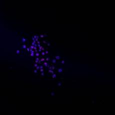 Anti-ATRX antibody [2-E7]