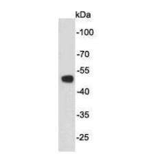 Anti-P53 antibody [C8-A11]