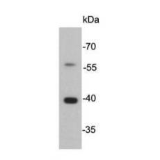 Anti-Cathepsin B antibody [J11-A11]