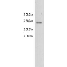 Anti-LDH-A antibody [20-179]