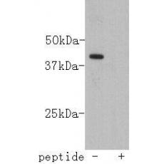 Anti-LASS2 antibody [B3-2]