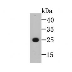 Anti-BLCAP antibody