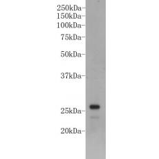 Anti-LIN28A antibody [A4-A6]