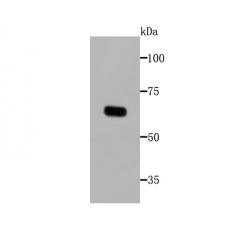 Anti-Tyrosinase antibody [C2-B5]