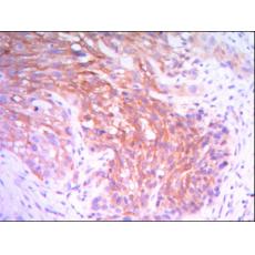 Anti-HK2 antibody [F1-D3]