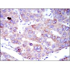 Anti-EEF2 antibody [H1-B6]