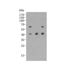 Anti-CD79a antibody [C1-E8]