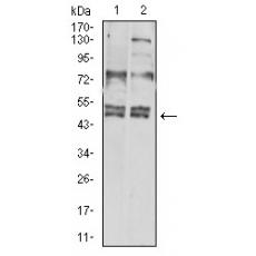 Anti-CD183 antibody [5C10E6]