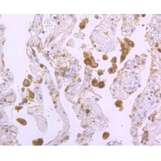 Anti-Tim3 antibody [1E3]