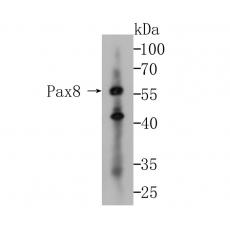 Anti-Pax8 antibody [6G5]