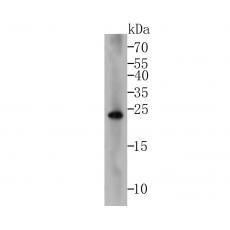 Anti-BCL2 antibody [9F1]