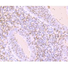 Anti-KIM1 antibody [AH24-32]