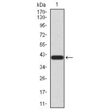 Anti-NTRK2 antibody [6B-C4]