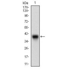 Anti-CDH17 antibody [D10-E1]