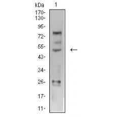 Anti-AP2 gamma antibody [A5-A11]