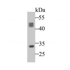 Anti-Cathepsin D antibody [13F3]