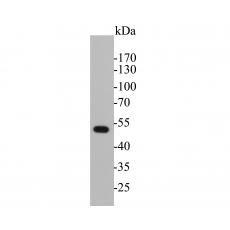 Anti-Cytokeratin 17 antibody [A2B11]