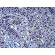 Anti-LEF1 antibody [B11-A4]