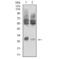 Anti-CD215 antibody [5F10D9]