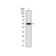 Anti-CAMK4 antibody [B8-C5]