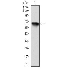 Anti-RSK2 antibody [D2-E10]