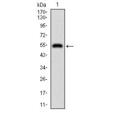 Anti-DIS3L2 antibody [B2-C7]