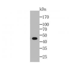 Anti-HLA Class 1 ABC antibody [11C3]