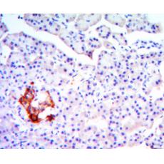 Anti-KLHL13 antibody [B12-D1]