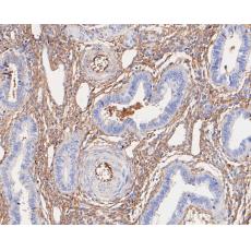 Anti-Alpha-2-macroglobulin antibody [A5-A9]